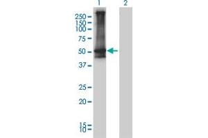 Western Blot analysis of ARRB2 expression in transfected 293T cell line by ARRB2 monoclonal antibody (M01), clone 3G1.