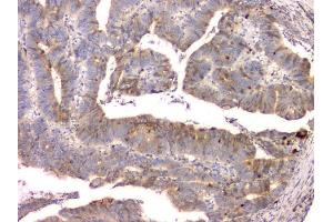 IHC analysis of Cystatin C/CST3 using anti-Cystatin C/CST3 antibody (ABIN6719299). (CST3 anticorps  (AA 31-146))