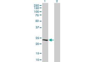 Western Blot analysis of CSN1S1 expression in transfected 293T cell line by CSN1S1 MaxPab polyclonal antibody. (Casein alpha S1 anticorps  (AA 1-185))