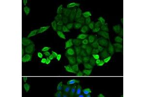 Immunofluorescence analysis of MCF-7 cells using PTS Polyclonal Antibody (PTS anticorps)
