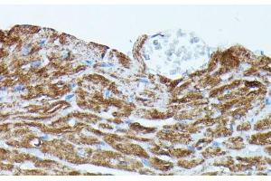 Immunohistochemistry of paraffin-embedded Mouse heart using PDE3A Polyclonal Antibody at dilution of 1:100 (40x lens).