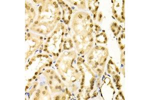 Immunohistochemistry of paraffin-embedded human kidney using MAPK3 Antibody.