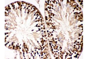 Anti- PBK Picoband antibody, IHC(P) IHC(P): Mouse Testis Tissue