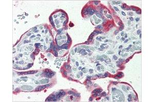 Immunohistochemical staining of Placenta using AP31137PU-N ERP44 antibody (ERP44 anticorps  (C-Term))