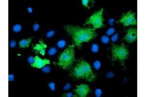 Immunofluorescence (IF) image for anti-Katanin P80 (WD Repeat Containing) Subunit B 1 (KATNB1) antibody (ABIN1498988) (KATNB1 anticorps)