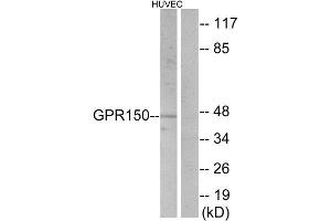 Western Blotting (WB) image for anti-G Protein-Coupled Receptor 150 (GPR150) (C-Term) antibody (ABIN1852896) (GPR150 anticorps  (C-Term))