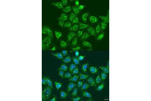 Immunofluorescence analysis of U2OS cells using UBE2A antibody (ABIN6132759, ABIN6149781, ABIN6149783 and ABIN6216187) at dilution of 1:100. (UBE2A anticorps  (AA 1-152))