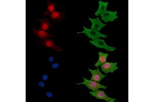 anti-Ubiquitin-Conjugating Enzyme E2W (UBE2W) antibody