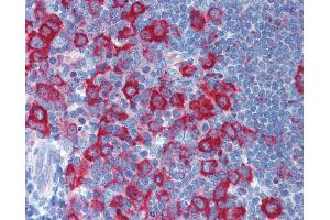 Anti-PRKRA / PACT antibody IHC of human tonsil.