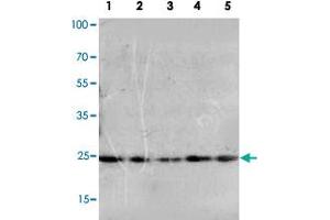Western blot analysis of whole cell extracts with FGF10 polyclonal antibody . (FGF10 anticorps  (N-Term))