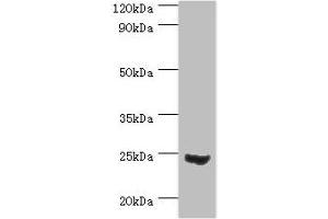 Western blot All lanes: Mitotic spindle assembly checkpoint protein MAD2A antibody at 3 μg/mL + 293T whole cell lysate Secondary Goat polyclonal to rabbit IgG at 1/10000 dilution Predicted band size: 24, 11 kDa Observed band size: 24 kDa (MAD2L1 anticorps  (AA 1-205))
