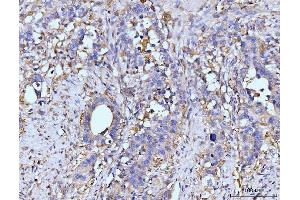 IHC analysis of GLUL using anti-GLUL antibody (ABIN7602403). (GLUL anticorps  (AA 74-373))