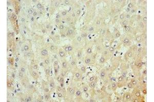 Immunohistochemistry of paraffin-embedded human liver tissue using ABIN7159091 at dilution of 1:100