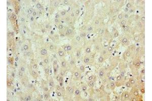 Immunohistochemistry of paraffin-embedded human liver tissue using ABIN7159091 at dilution of 1:100 (MKS1 anticorps  (AA 150-300))