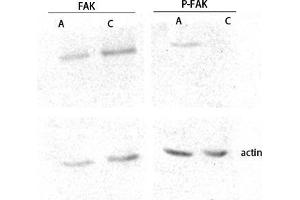 Western Blot (WB) analysis of lysis using FAK antibody. (FAK anticorps  (Thr402, Thr421, Thr423))
