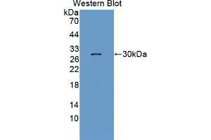 Western blot analysis of the recombinant protein. (NUP62 anticorps  (AA 186-432))