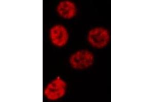 ABIN6269188 staining MCF-7 cells by IF/ICC.