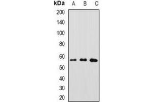 Western blot analysis of GFRA1 expression in MCF7 (A), A549 (B), SW480 (C) whole cell lysates. (GFRA1 anticorps)