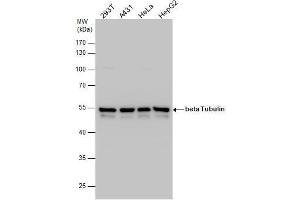 WB Image beta Tubulin antibody detects beta Tubulin protein by western blot analysis.
