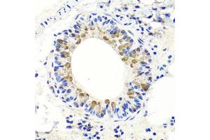 Immunohistochemistry of paraffin-embedded mouse lung using ENDOG antibody at dilution of 1:100 (x40 lens).