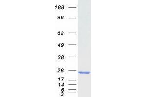 Validation with Western Blot