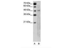 Image no. 1 for anti-Solute Carrier Family 25, Member 46 (SLC25A46) (AA 31-80) antibody (ABIN205025) (SLC25A46 anticorps  (AA 31-80))