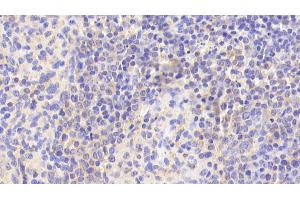 Detection of EFNA3 in Human Spleen Tissue using Polyclonal Antibody to Ephrin A3 (EFNA3) (Ephrin A3 anticorps  (AA 30-238))