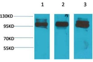 Western Blot (WB) analysis of 1) K562, 2)Mouse Heart Tissue, 3) Rat Heart Tissue with STAT2 Rabbit Polyclonal Antibody diluted at 1:2000. (STAT2 anticorps)