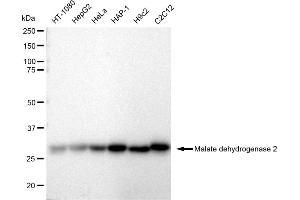 Western blotting analysis using Malate dehydrogenase 2 antibody (ABIN7799327).