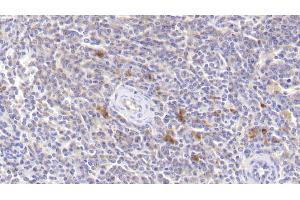 Detection of JAK3 in Human Spleen Tissue using Polyclonal Antibody to Janus Kinase 3 (JAK3)