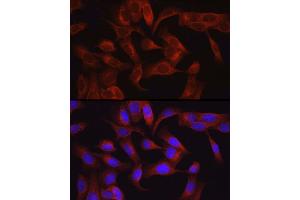 Immunofluorescence analysis of U2OS cells using T Rabbit pAb (ABIN6130537, ABIN6143503, ABIN6143504 and ABIN6215581) at dilution of 1:50 (40x lens).