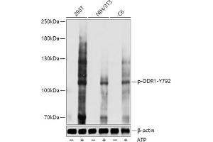 Western blot analysis of extracts of various cell lines, using Phospho-DDR1-Y792 antibody (ABIN7266789) at 1:1000 dilution. (DDR1 anticorps  (pTyr792))