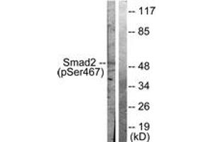 Western blot analysis of extracts from HepG2 cells treated with PMA 125ng/ml 15', using Smad2 (Phospho-Ser467) Antibody.