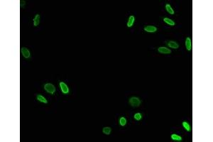 Immunofluorescence staining of Hela cells with ABIN7139197 at 1:7. (HIST1H3A anticorps  (H3K79ac))