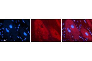 Rabbit Anti-DHX30 Antibody    Formalin Fixed Paraffin Embedded Tissue: Human Adult heart  Observed Staining: Cytoplasmic Primary Antibody Concentration: 1:100 Secondary Antibody: Donkey anti-Rabbit-Cy2/3 Secondary Antibody Concentration: 1:200 Magnification: 20X Exposure Time: 0. (DHX30 anticorps  (N-Term))