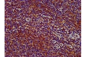 IHC image of ABIN7169553 diluted at 1:400 and staining in paraffin-embedded human lymph node tissue performed on a Leica BondTM system. (Sialoadhesin/CD169 anticorps  (AA 572-697))