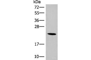 Western blot analysis of 293T cell lysate using DHFR Polyclonal Antibody at dilution of 1:400 (Dihydrofolate Reductase anticorps)