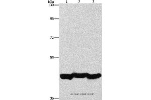 Western blot analysis of A549 cell and mouse liver tissue, hepG2 cell, using PGK1 Polyclonal Antibody at dilution of 1:1000 (PGK1 anticorps)