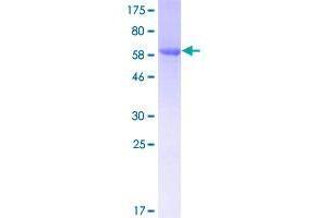 Image no. 1 for Clusterin Associated Protein 1 (CLUAP1) (AA 1-247) protein (GST tag) (ABIN1349764)