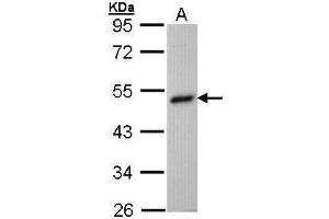 WB Image Sample (30 ug of whole cell lysate) A: Hep G2 , 10% SDS PAGE antibody diluted at 1:1000 (BHMT anticorps)