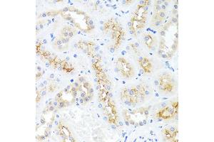 Immunohistochemistry of paraffin-embedded rat kidney using CXCL8 antibody (ABIN6290535) at dilution of 1:100 (40x lens).