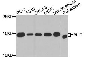 Western blot analysis of extracts of various cells, using BLID antibody. (BLID anticorps)