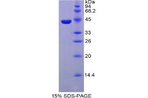 SDS-PAGE analysis of Mouse Parathyroid Hormone Protein.