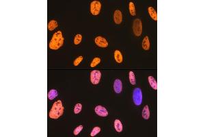 Immunofluorescence analysis of U-2 OS cells using hnRNP U Rabbit mAb (ABIN1679689, ABIN3018741, ABIN3018742 and ABIN7101656) at dilution of 1:100 (40x lens).