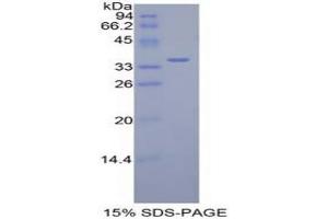 SDS-PAGE analysis of Mouse Dispatched Homolog 1 Protein. (DISP1 Protéine)