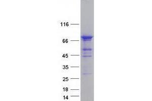 Validation with Western Blot (WRAP53 Protein (Transcript Variant 2) (Myc-DYKDDDDK Tag))