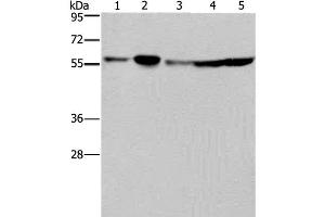 Western Blot analysis of Hela, 293T, A549, HT-29 and K562 cell using NUP50 Polyclonal Antibody at dilution of 1:200 (NUP50 anticorps)