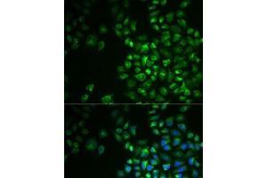 Immunofluorescence analysis of MCF7 cells using POLG2 Polyclonal Antibody (POLG2 anticorps)