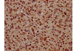 IHC image of ABIN7145737 diluted at 1:500 and staining in paraffin-embedded human glioma performed on a Leica BondTM system. (BSX anticorps  (AA 1-233))