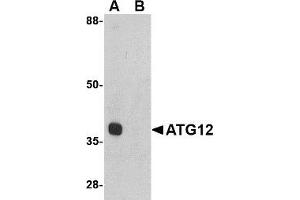 Western blot. (ATG12 anticorps  (Middle Region))